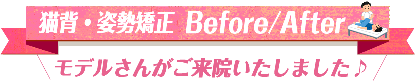 猫背・姿勢調整 Before and Afterモデルさんがご来院いたしました。